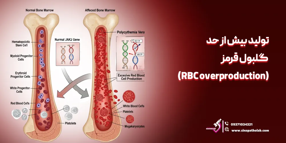 تولید بیش از حد گلبول قرمز (RBC overproduction)