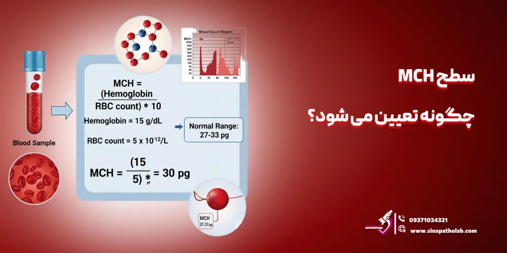 سطح MCH چگونه تعیین می شود؟