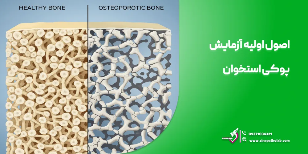 اصول اولیه آزمایش پوکی استخوان