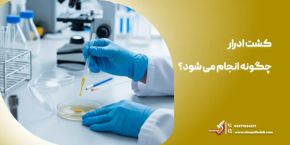 نحوه انجام آزمایش کشت ادرار