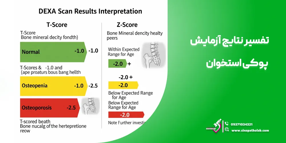 تفسیر نتایج آزمایش پوکی استخوان
