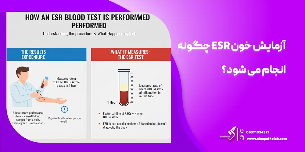 آزمایش خون ESR چگونه انجام می شود؟