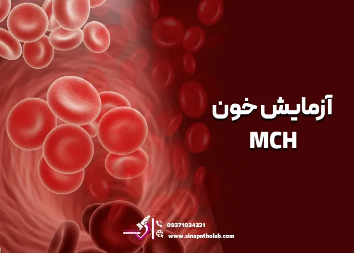 آزمایش خون MCH: علائم، علل، تشخصی و درمان