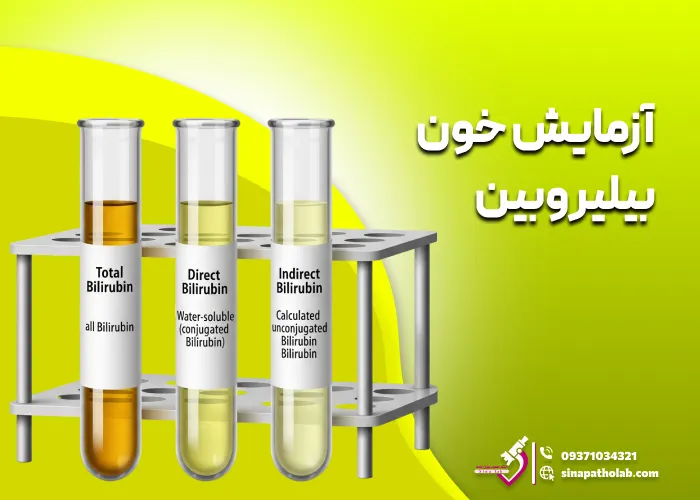 آزمایش خون بیلی‌ روبین: کاربرد، ضرورت و تفسیر نتایج