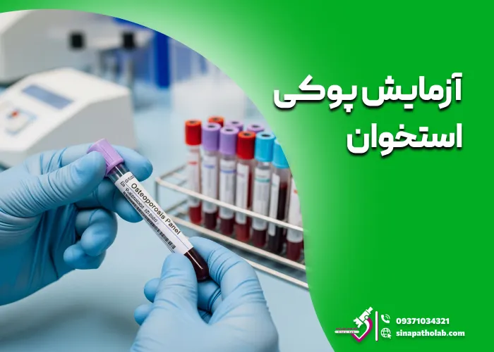 آزمایش پوکی استخوان: تست تراکم استخوان و نحوه انجام آن