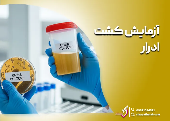 آزمایش کشت ادرار: نحوه انجام، دلایل و تفسیر نتایج