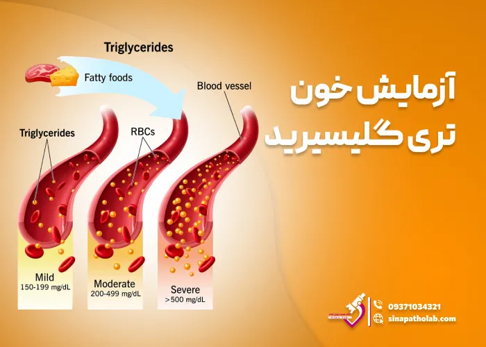 آزمایش خون تری گلیسیرید