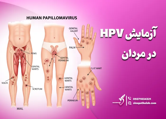 آزمایش HPV در مردان
