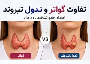 تفاوت گواتر و ندول تیروئید