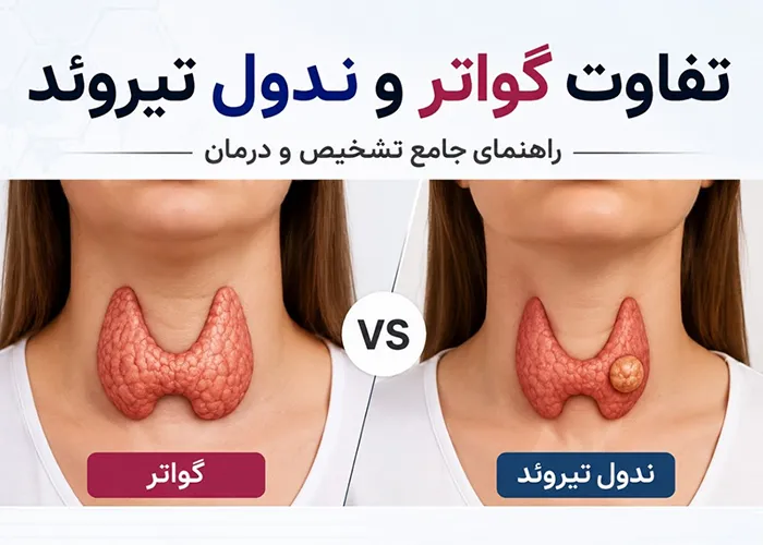 تفاوت گواتر و ندول تیروئید
